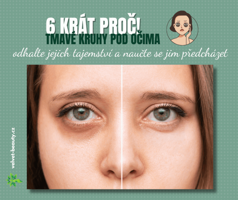 tmavé kruhy pod očima